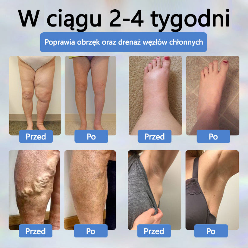 Detoksykujący krem ziołowy z czarnym kminkiem Cvreoz®🩹