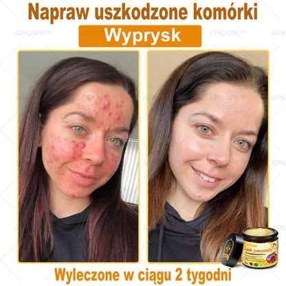 ΑPΚΑPK™ Jad Pszczoły Kompleksowy Krem🥇pomaga w leczeniu problemów skórnych, takich jak: zmarszczki, blizny, plamy pigmentacyjne, rozstępy, trądzik, łuszczyca, egzema, zmiany skórne, podrażnienia, stany zapalne i inne problemy skórne🔥🔥