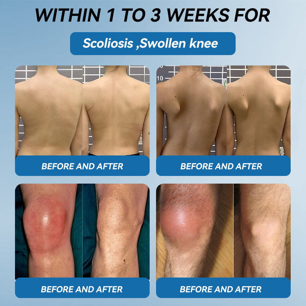 𝖯𝗂𝖼𝗱𝗈® BPC-157 Krem regenerujący stawy 🦴 Skutecznie łagodzi artretyzm, neuropatię, reumatyzm, kontuzje sportowe i wiele więcej 👍👍👍👍