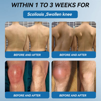 𝖯𝗂𝖼𝗱𝗈® BPC-157 Krem regenerujący stawy 🦴 Skutecznie łagodzi artretyzm, neuropatię, reumatyzm, kontuzje sportowe i wiele więcej 👍👍👍