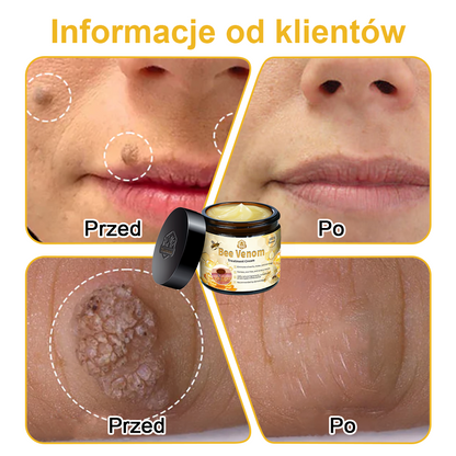 🏵️Turonu™ leczniczy krem do skóry z jadem pszczelim (zalecany przez AAD)🌷🌷