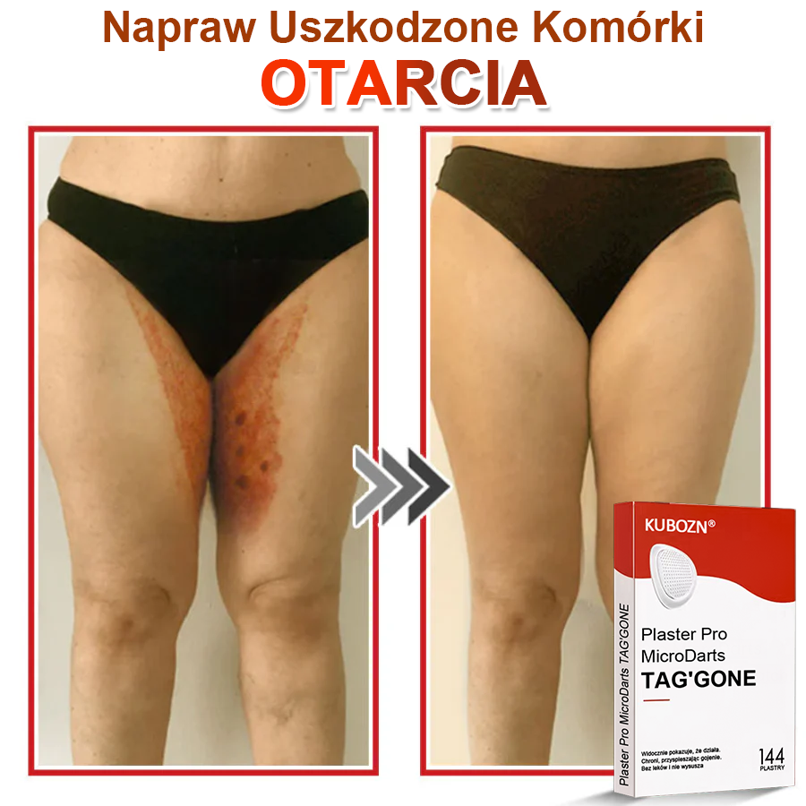 KUBOZN® Mikroigłowy Botaniczny Plaster na Usuwanie Brodawek Skórnych✨✨