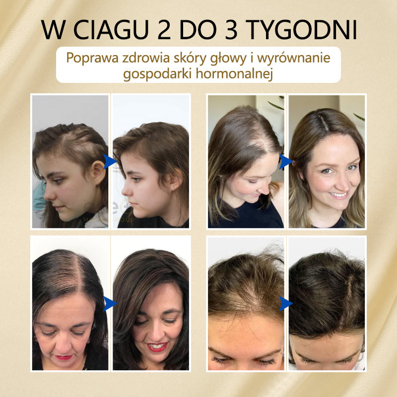 Timilk® VitaStrand Biotin Hair Growth Spray✅ ✅Gęste, lśniące włosy w zaledwie kilka tygodni🔥🔥🔥🔥