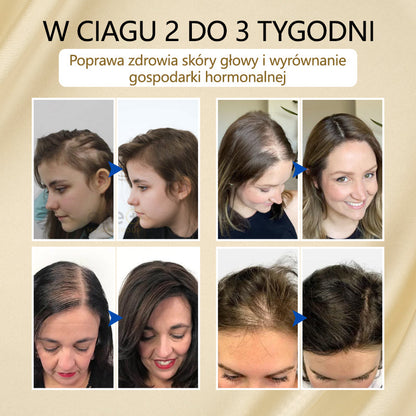 Timilk® VitaStrand Biotin Hair Growth Spray✅ ✅Gęste, lśniące włosy w zaledwie kilka tygodni🔥🔥🔥🔥