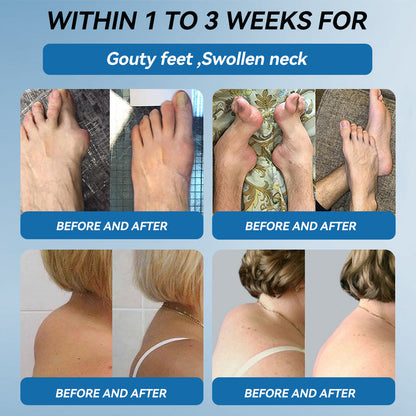 𝖯𝗂𝖼𝗱𝗈® BPC-157 Krem regenerujący stawy 🦴 Skutecznie łagodzi artretyzm, neuropatię, reumatyzm, kontuzje sportowe i wiele więcej 👍👍👍