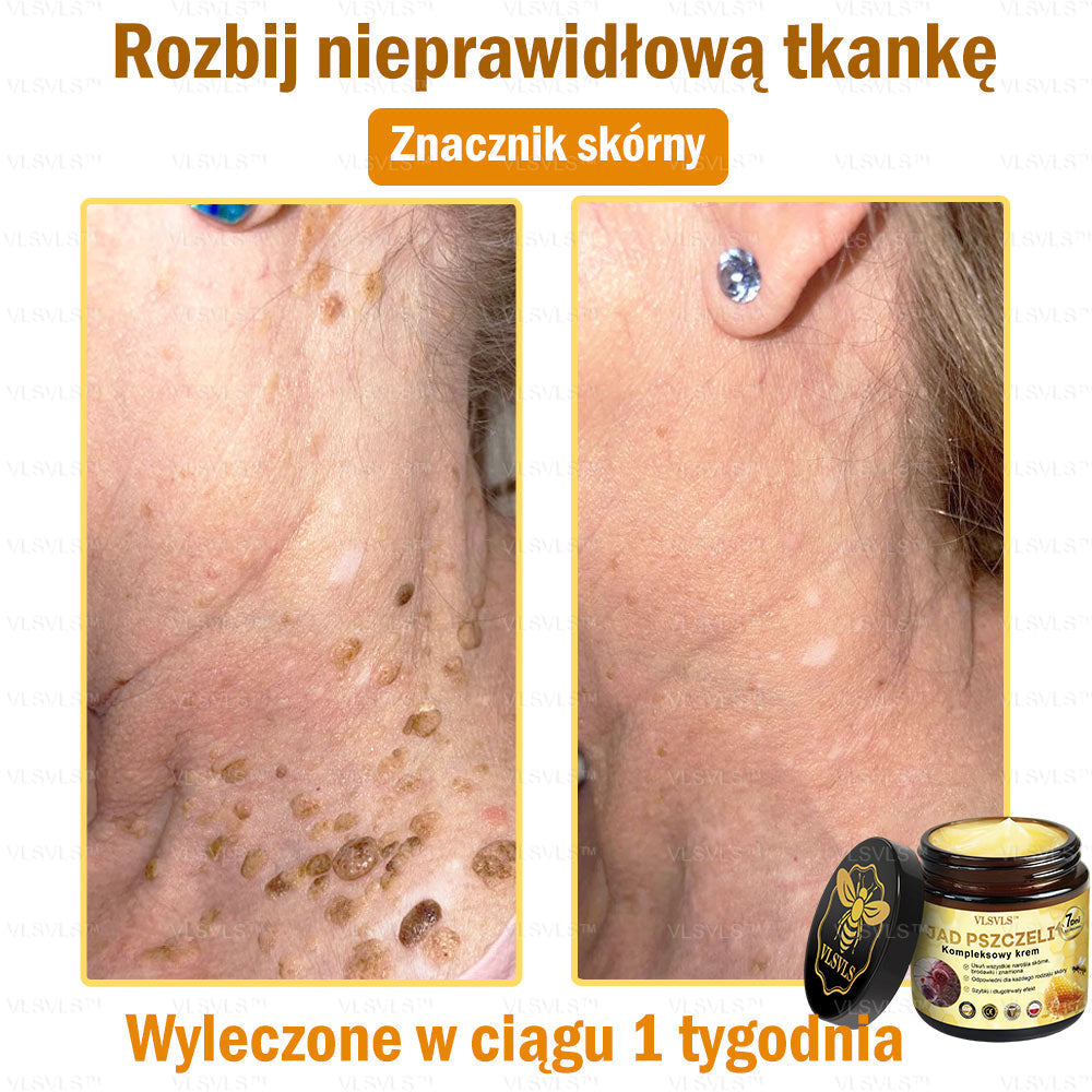 VLSVLS™ Krem Komprehensywny z Jadami Pszczół 🇵🇱 Rekomendowany przez Dermatologów🐝🐝🐝🐝