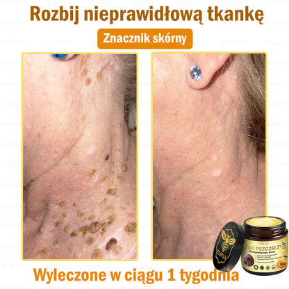 VLSVLS™ Krem Komprehensywny z Jadami Pszczół 🇵🇱 Rekomendowany przez Dermatologów🐝🐝🐝🐝