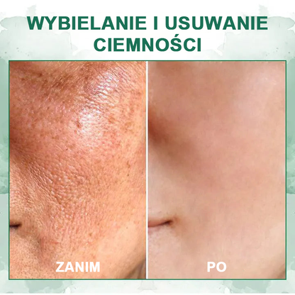 【✨Za pobraniem✨】Wyprzedaż ostatniego dnia 80% taniej - Ujędrniające serum regenerujące Fubsta™🔥🔥🔥