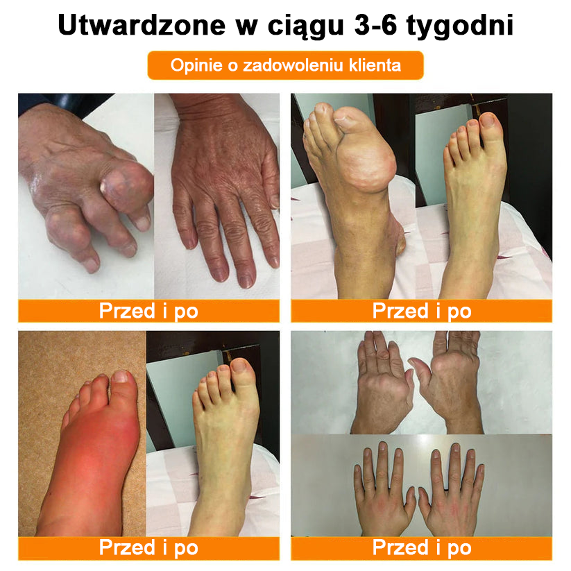 ✅Oficjalny sklep: Ouryard™ Olej magnezowy i miód w sprayu do naprawy stawów👨‍⚕️Zatwierdzony przez Polską Agencję Leków, Wyrobów Medycznych i Produktów Biologicznych (URPL)🔥🔥