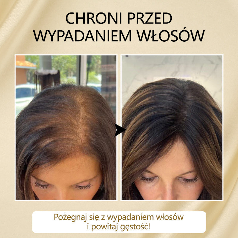 Timilk® VitaStrand Biotin Hair Growth Spray✅ ✅Gęste, lśniące włosy w zaledwie kilka tygodni🔥🔥🔥🔥