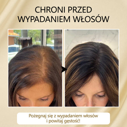 Timilk® VitaStrand Biotin Hair Growth Spray✅ ✅Gęste, lśniące włosy w zaledwie kilka tygodni🔥🔥🔥🔥