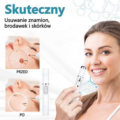 Cvreoz® nowy nieinwazyjny laser do usuwania pieprzyków i brodawek 🎉🎉🎉🎉