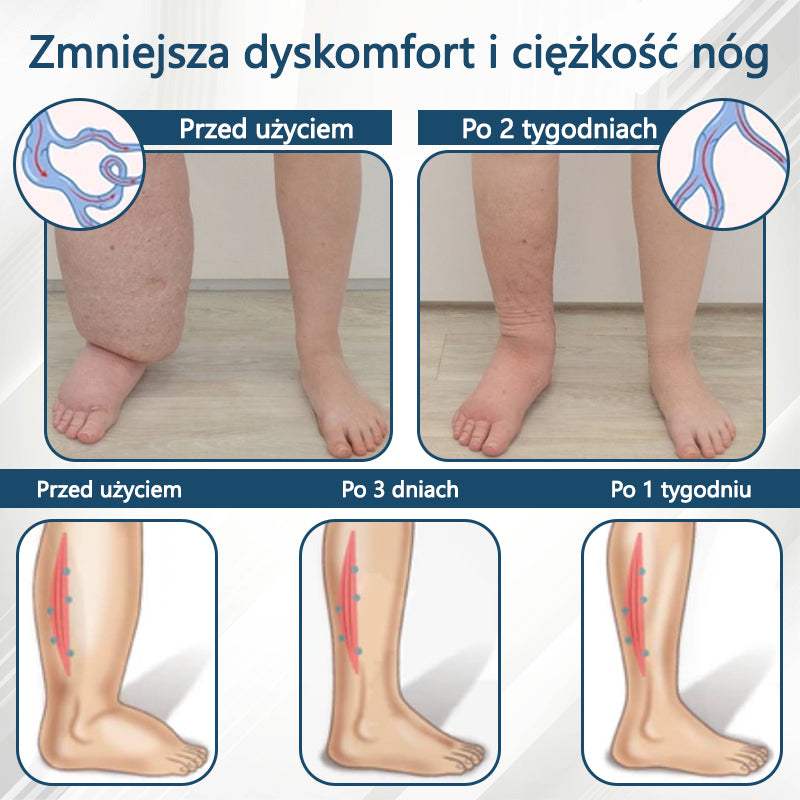 Detoksykujący krem ziołowy z czarnym kminkiem Cvreoz®🩹