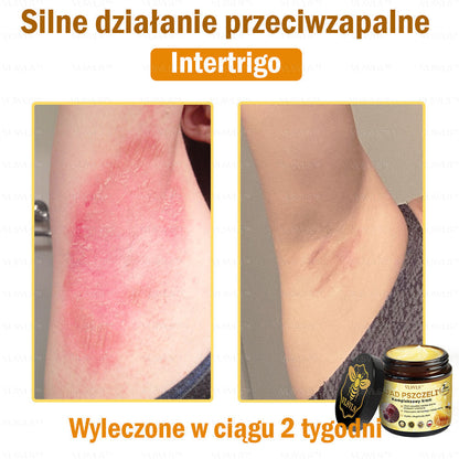 VLSVLS™ Krem Komprehensywny z Jadami Pszczół 🇵🇱 Rekomendowany przez Dermatologów🐝🐝🐝🐝