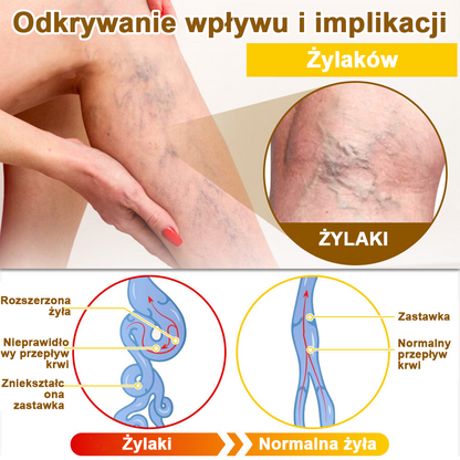 ✅flysmus™ Krem leczniczy z jadem pszczelim🐝: Leczenie egzemy, łuszczycy, trądziku, trądziku różowatego, infekcji grzybiczych, brodawek🐝