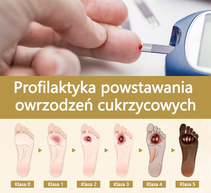 Cvreoz® Leczniczy spray do stóp cukrzycowych- zawiera jad pszczeli, który przyspiesza gojenie i zapobiega infekcjom!🌿🌿