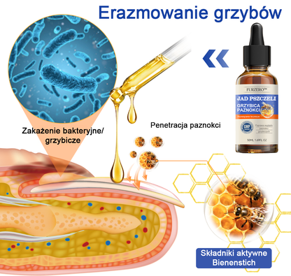 🐝👣Furzero™ Bienengift Nagelpilz Leczenie: Całkowite rozwiązanie problemu grzybicy paznokci🌟👣👣👣👣