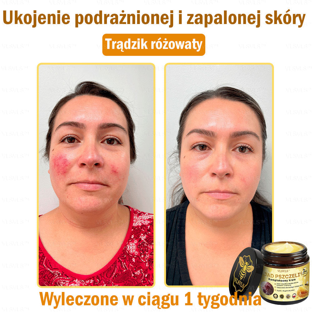 VLSVLS™ Krem Komprehensywny z Jadami Pszczół 🇵🇱 Rekomendowany przez Dermatologów🐝🐝🐝🐝
