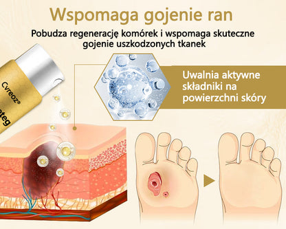 Cvreoz® Leczniczy spray do stóp cukrzycowych- zawiera jad pszczeli, który przyspiesza gojenie i zapobiega infekcjom!🌿🌿
