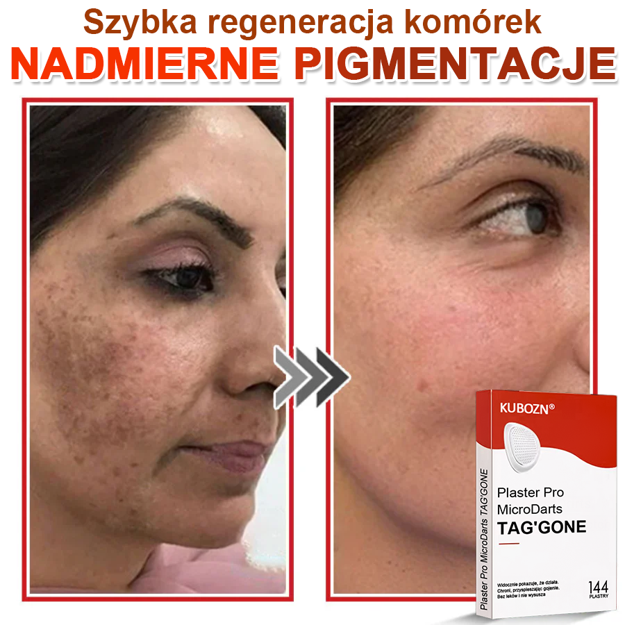 KUBOZN® Mikroigłowy Botaniczny Plaster na Usuwanie Brodawek Skórnych✨✨